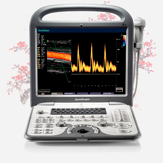 Ультразвуковой сканер S6Pro от SonoScape