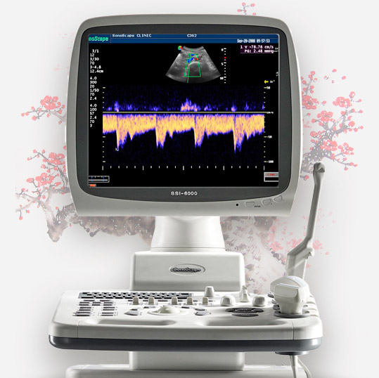 Ультразвуковой сканер SSI-6000 от SonoScape